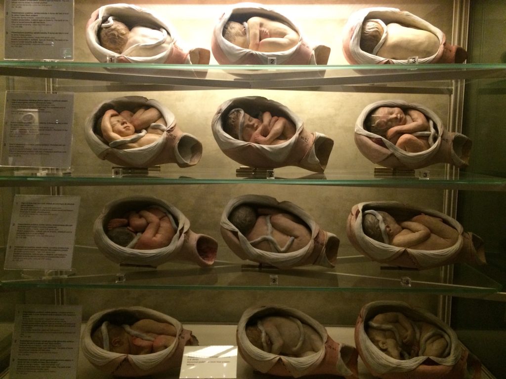Wax wombs made for early medical studies on display at Museo de Palazzo Poggi.