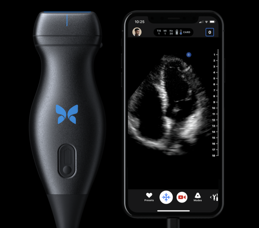 The ButterflyiQ's personal ultrasound tool won Best of Show honors at SXSW.