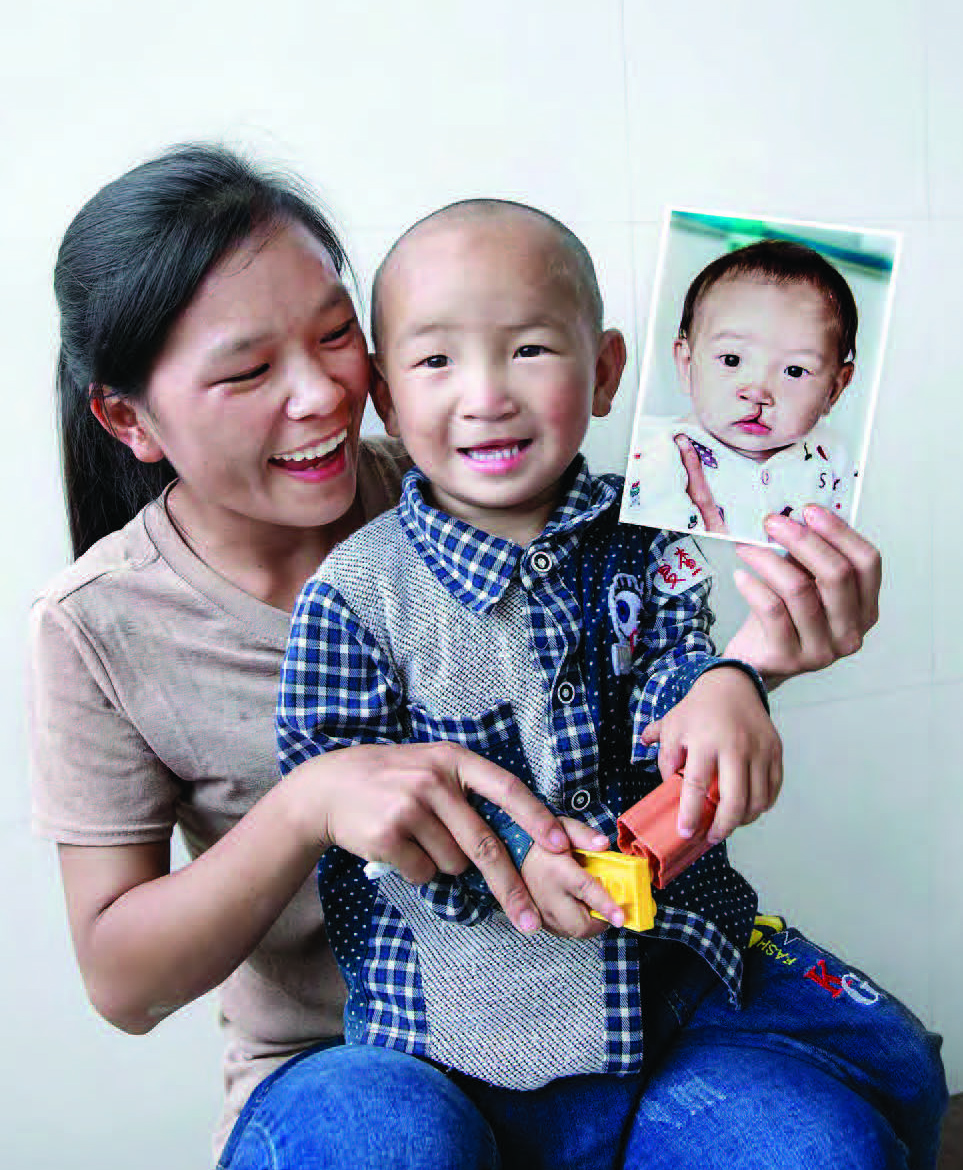 OPERATION SMILE