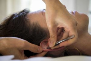 Ear Seeds Placing on Ear 2
